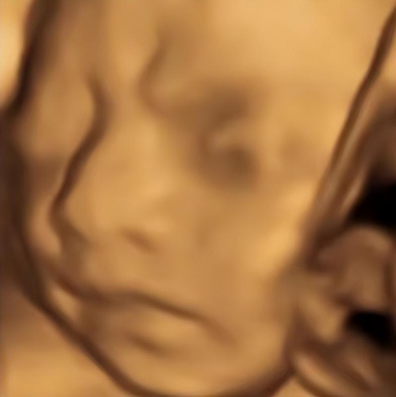 20240102094426-6593dafaba821